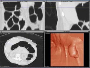 Colon_image004WebC